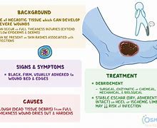 Slough Wound Adalah